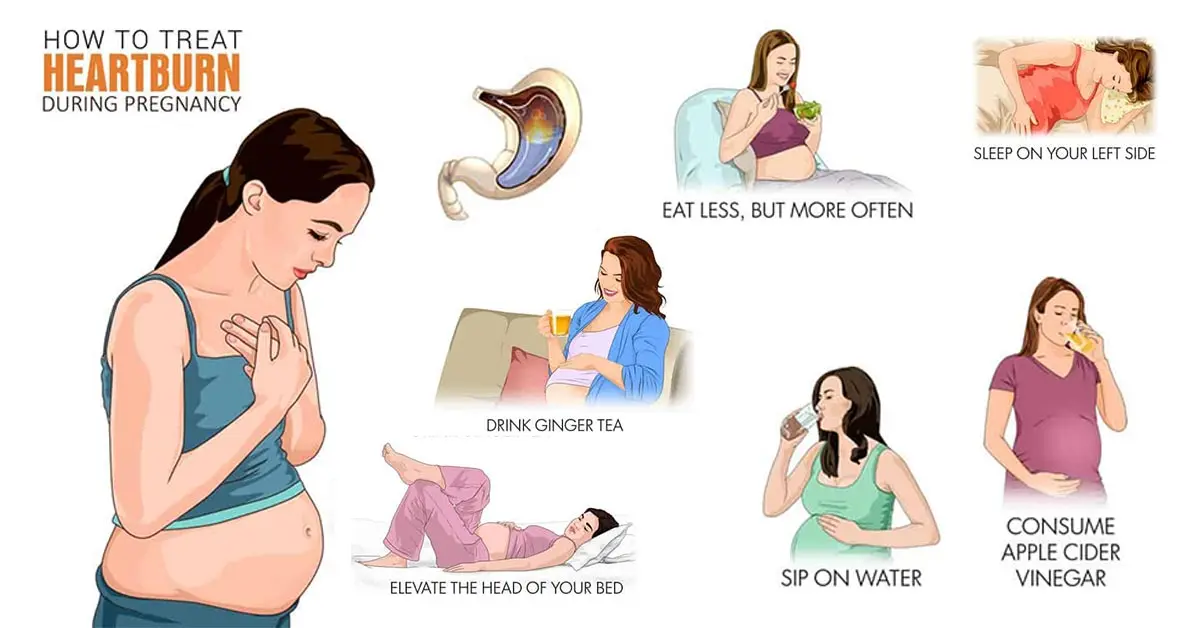 How to quickly get rid of heartburn during pregnancy