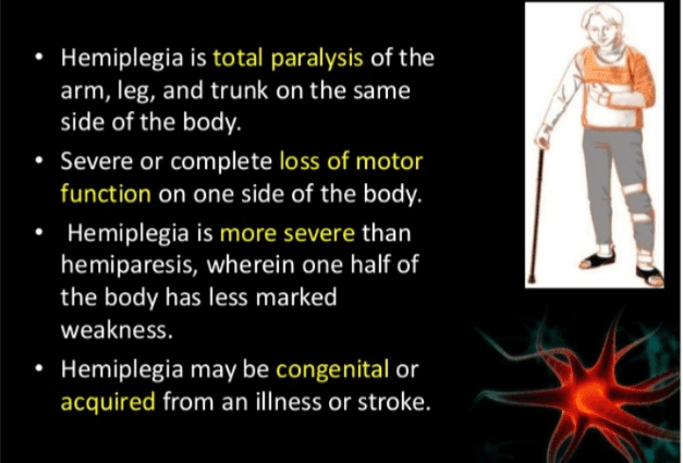 Hemiplegia, what is it?