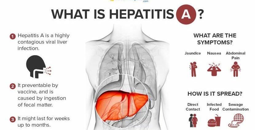 Symptoms of hepatitis A