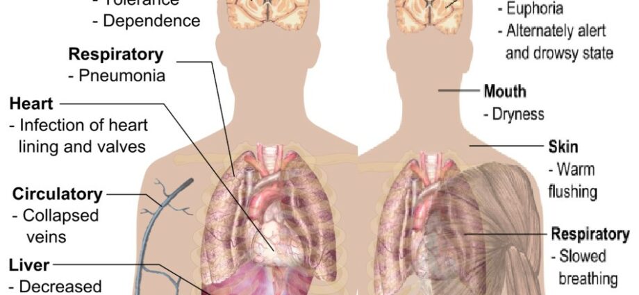 Heroin: what are the dangers?