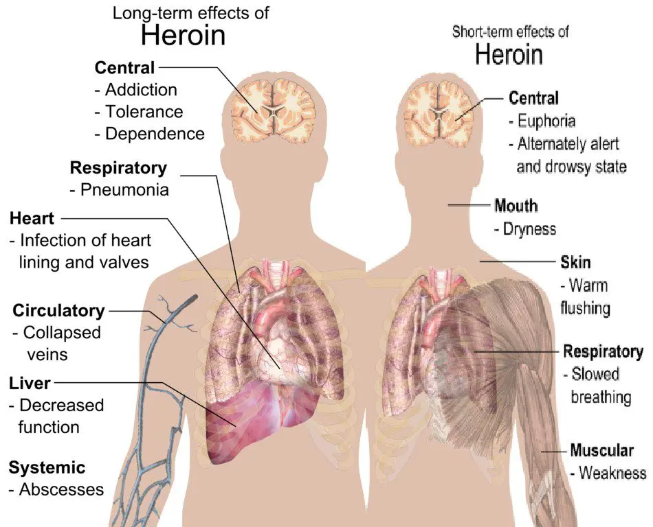 Heroin: what are the dangers?