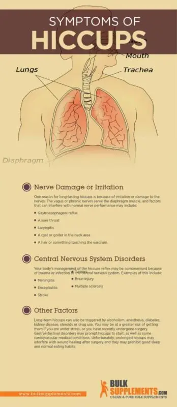 Hiccups, Hiccups causes, How to get rid of hiccups, Frequent hiccups, Hiccups after eating