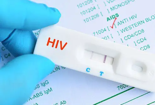 HIV test