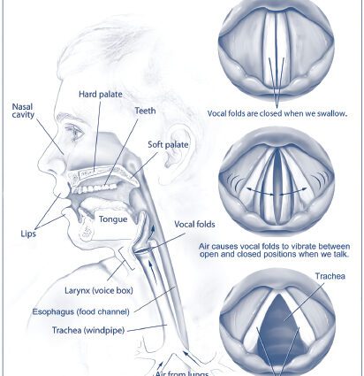 Hoarseness: have a hoarse voice, why?