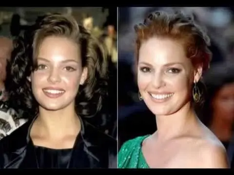 Hollywood stars with veneers: before and after photos