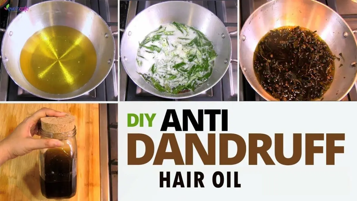 Home remedies for dandruff. Video recipe