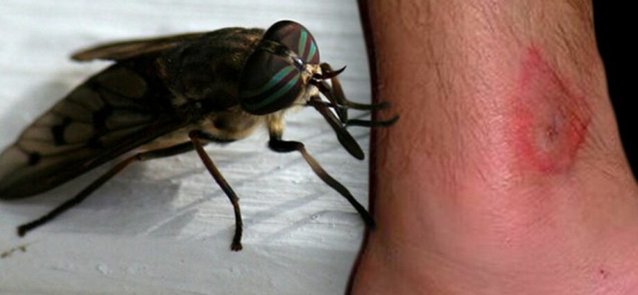 Muzzicone di mosca: qual hè u risicu di l'allergia?