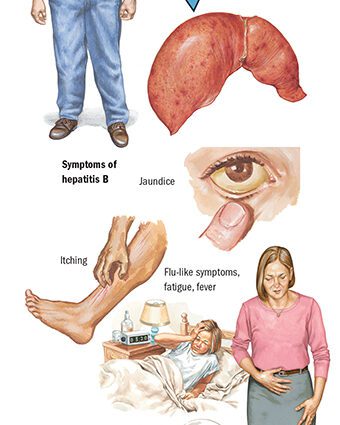 How can you get infected with hepatitis B and C: transmission routes