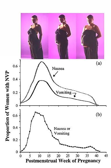 How long does nausea appear during pregnancy