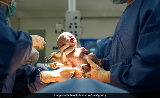 How many natural childbirth is possible after a cesarean section