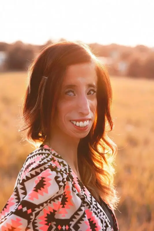 How the Ugliest Girl in the World Lives