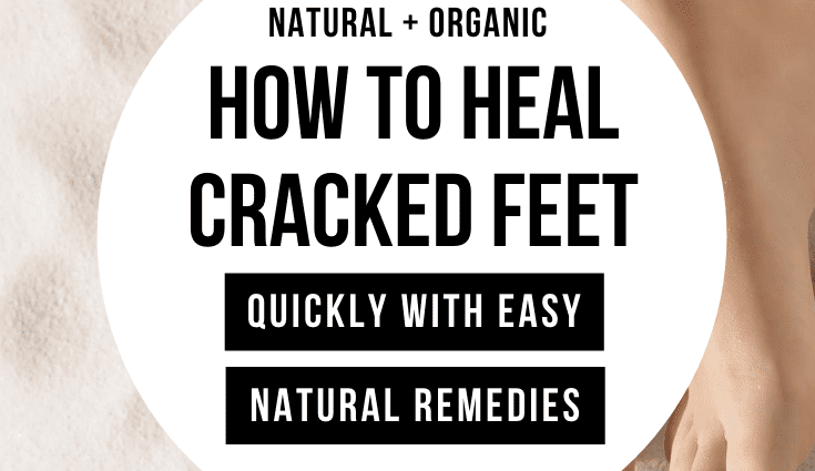 How to cure cracked heels: Healthy Food Near Me users answer