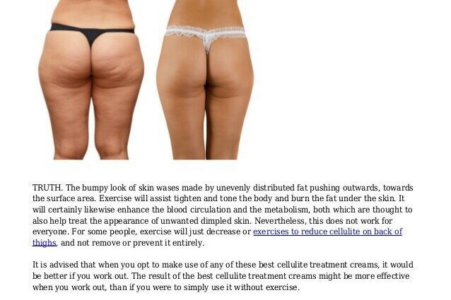 How to deal with cellulite: new methods