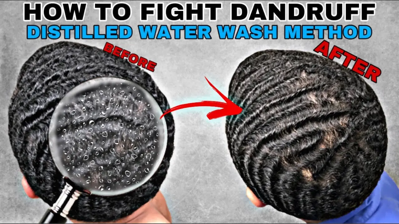 How to fight dandruff?