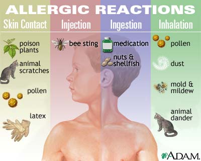 How to find the causes of allergies?