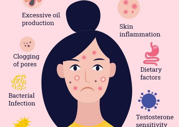 How to get rid of acne, acne, remove wrinkles and age spots