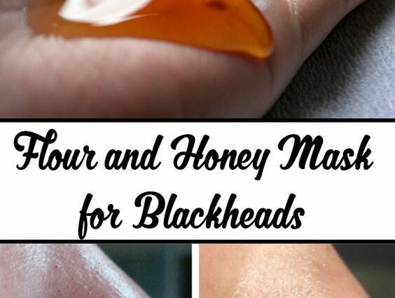 How to get rid of blackheads: quickly and permanently