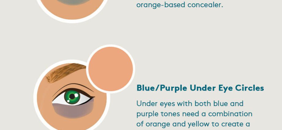 Bagaimana cara menghilangkan lingkaran biru di bawah mata? Video