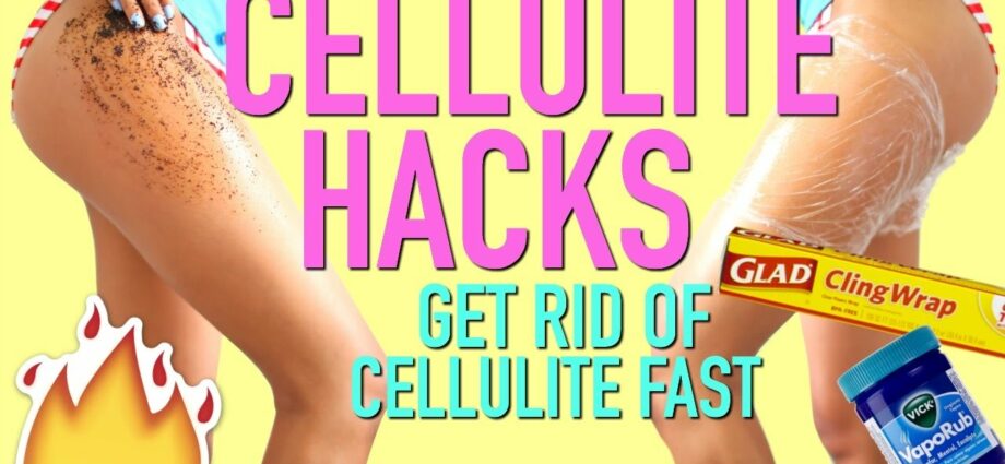 How to get rid of cellulite quickly? Video