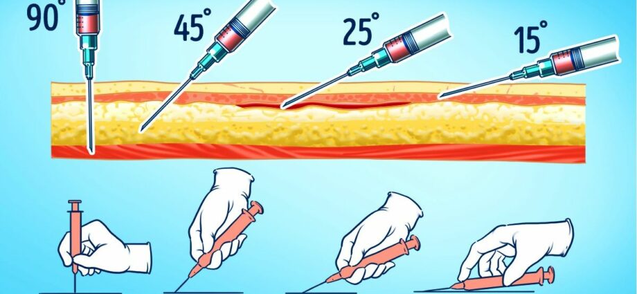 How to learn how to properly inject into a vein