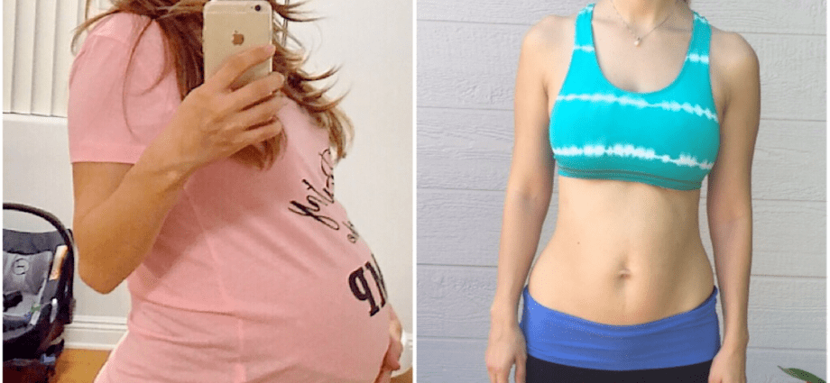 How to lose weight after childbirth quickly and without sports