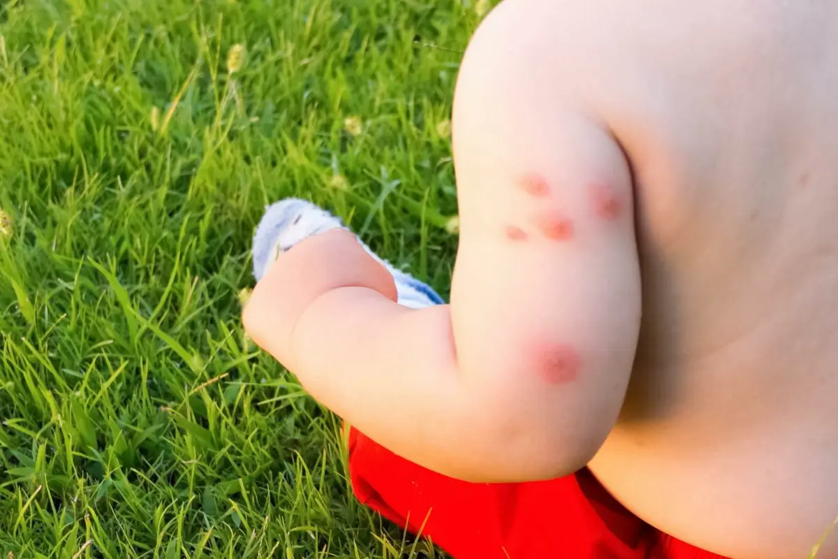 How to protect baby from mosquitoes?