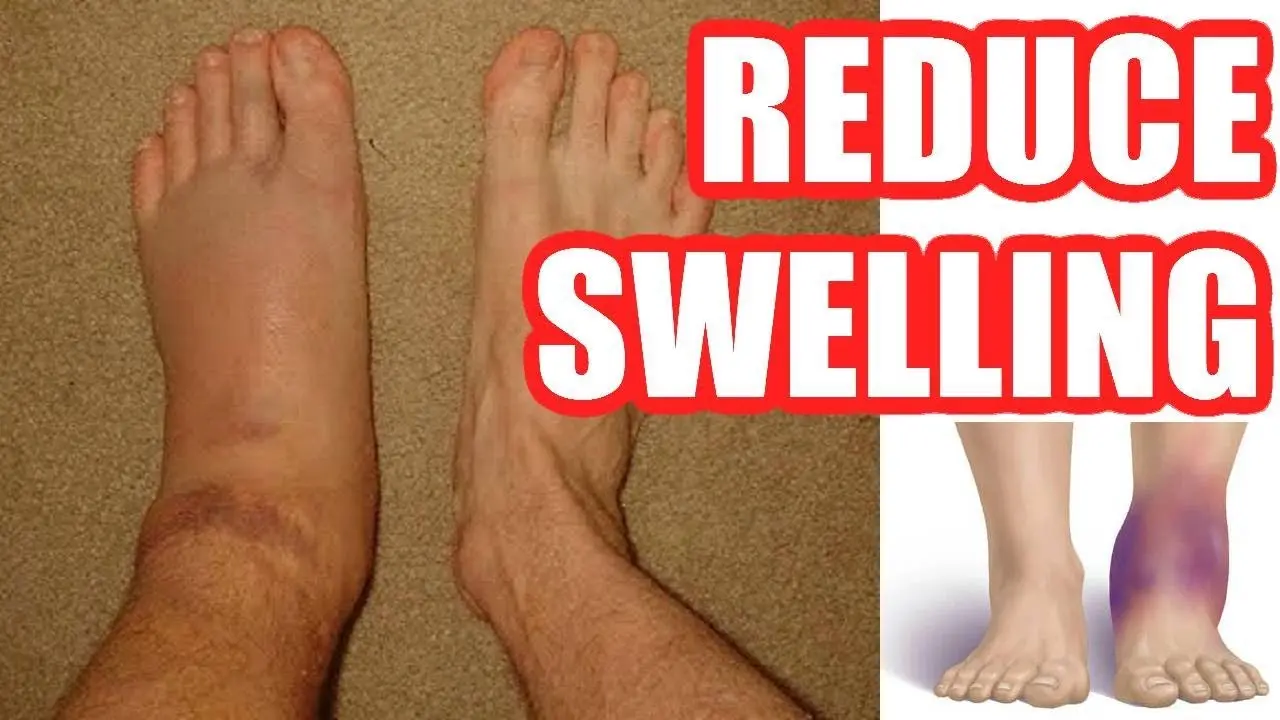 How to put an end to swollen feet?