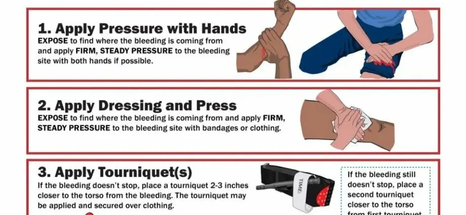 How to quickly stop bleeding from a cut at home