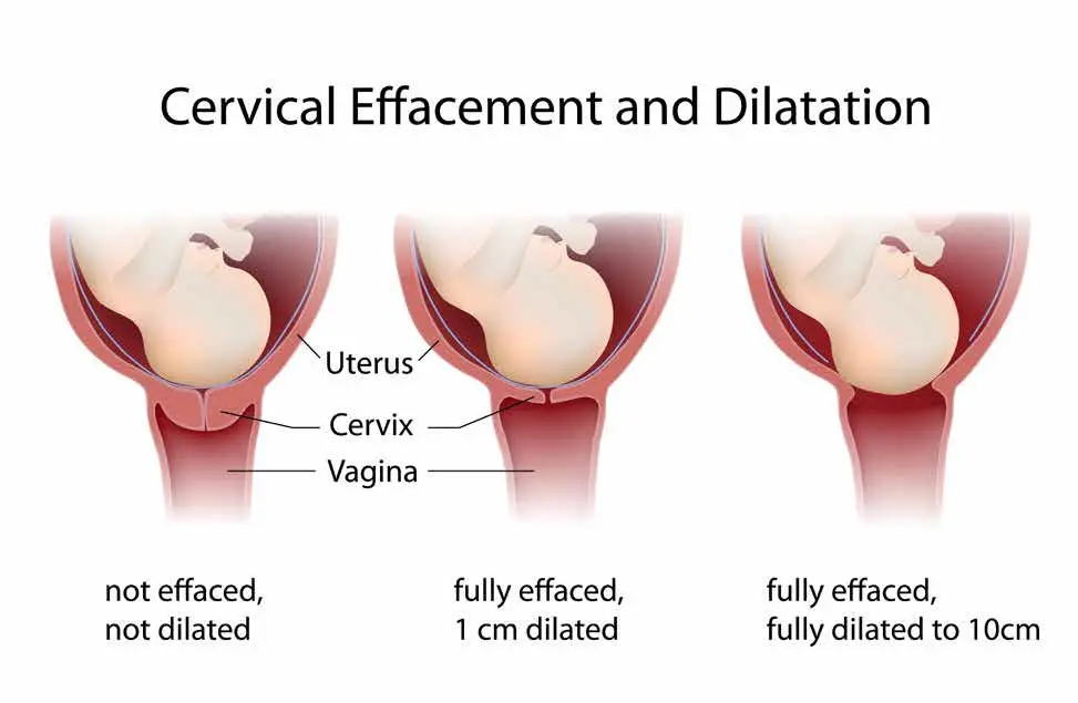 How to relieve pain during childbirth
