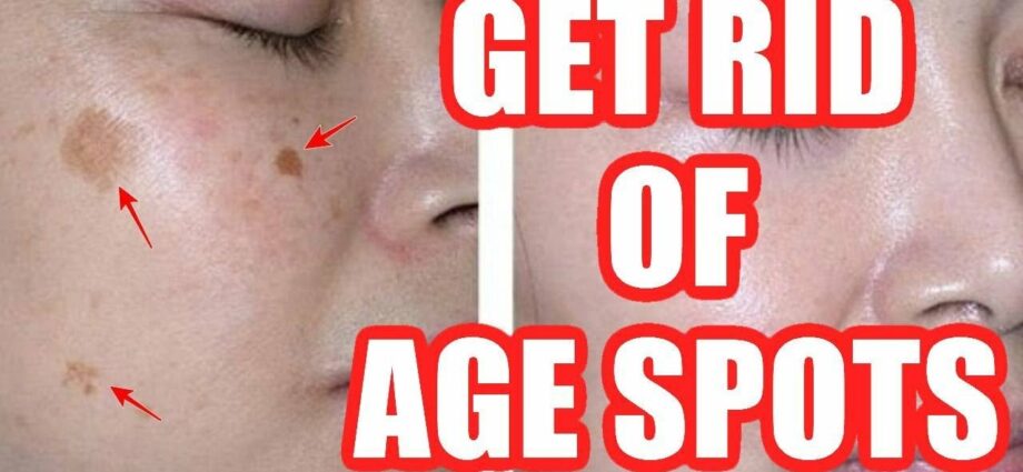 How to remove age spots. Video