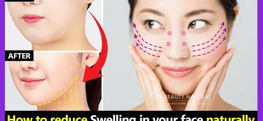How to remove facial swelling quickly? Video