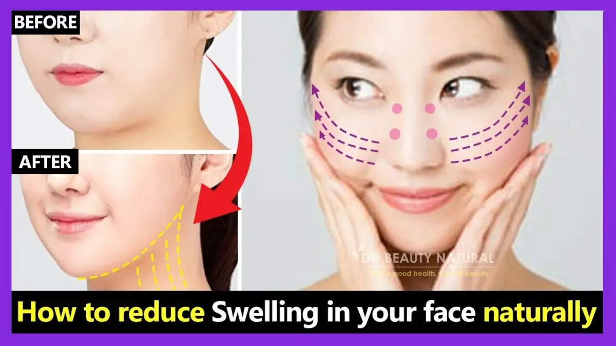 How to remove facial swelling quickly? Video