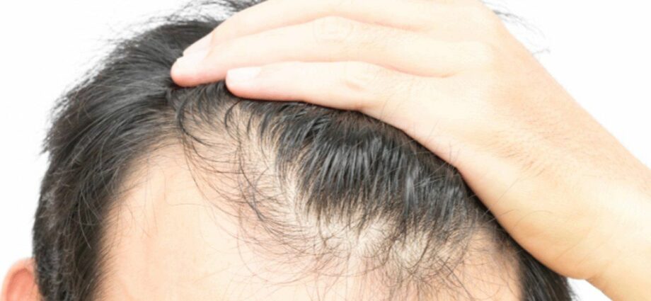 How to restore hair: new methods – Healthy Food Near Me