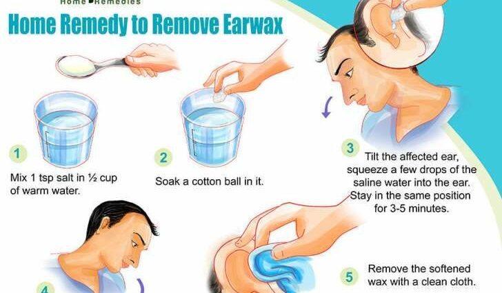 How to rinse your ear at home