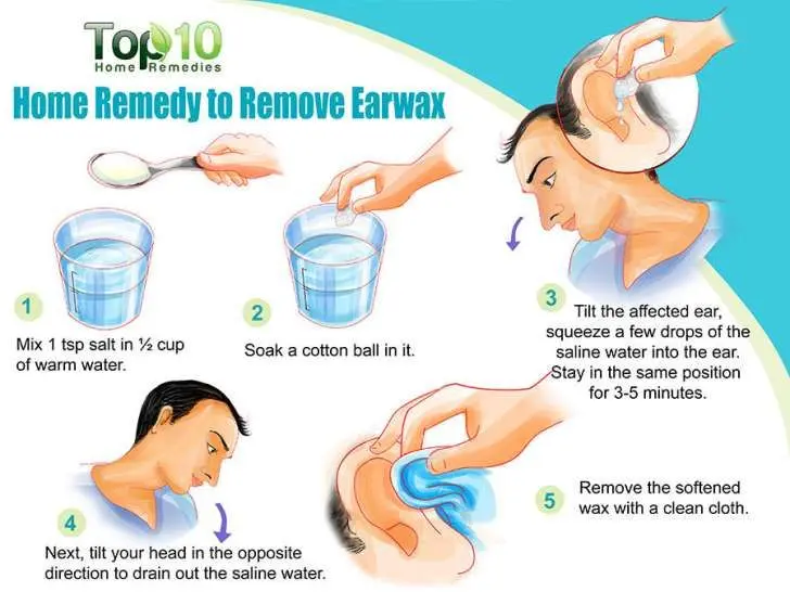 How to rinse your ear at home