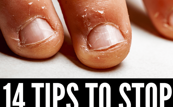 Comment empêcher un enfant de se ronger les ongles
