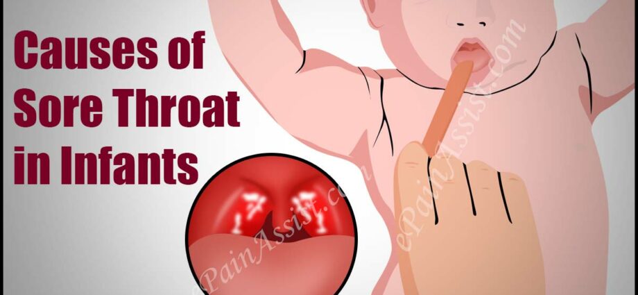 How to treat sore throat in infants. Video recommendations