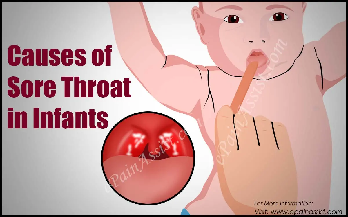 How to treat sore throat in infants. Video recommendations