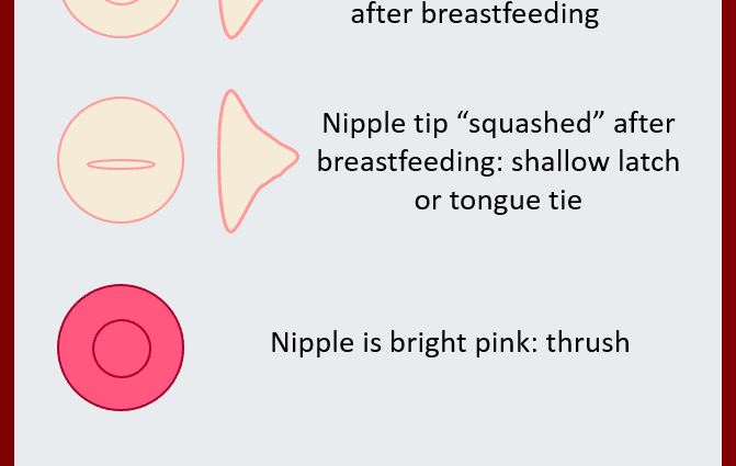 How to treat vasospasm of the nipple?