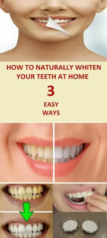 How to whiten teeth enamel at home? Video