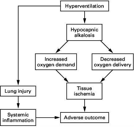 Hypocapnia