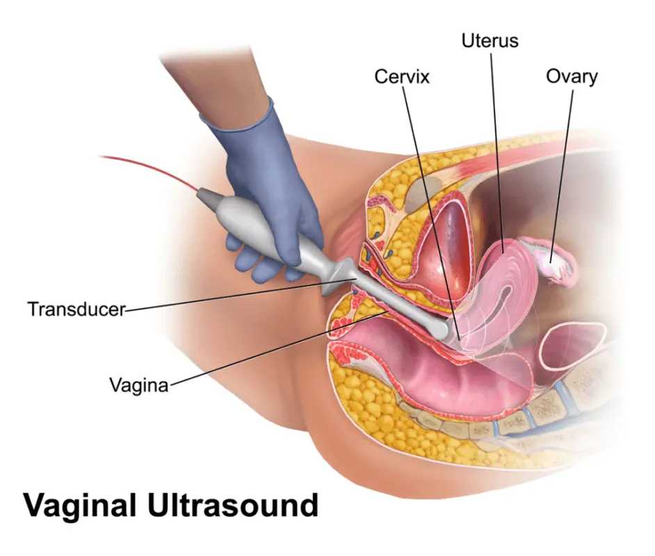 Hysterosonography