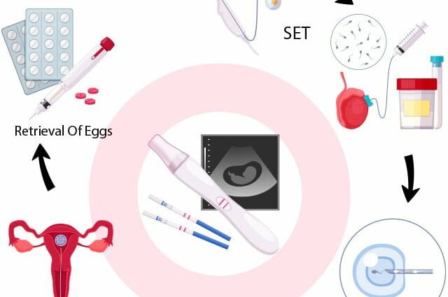 In-vitro-Fertilisation (IVF) bei männlicher Unfruchtbarkeit