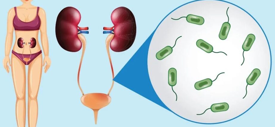 Increased leukocytes in urine during pregnancy, causes