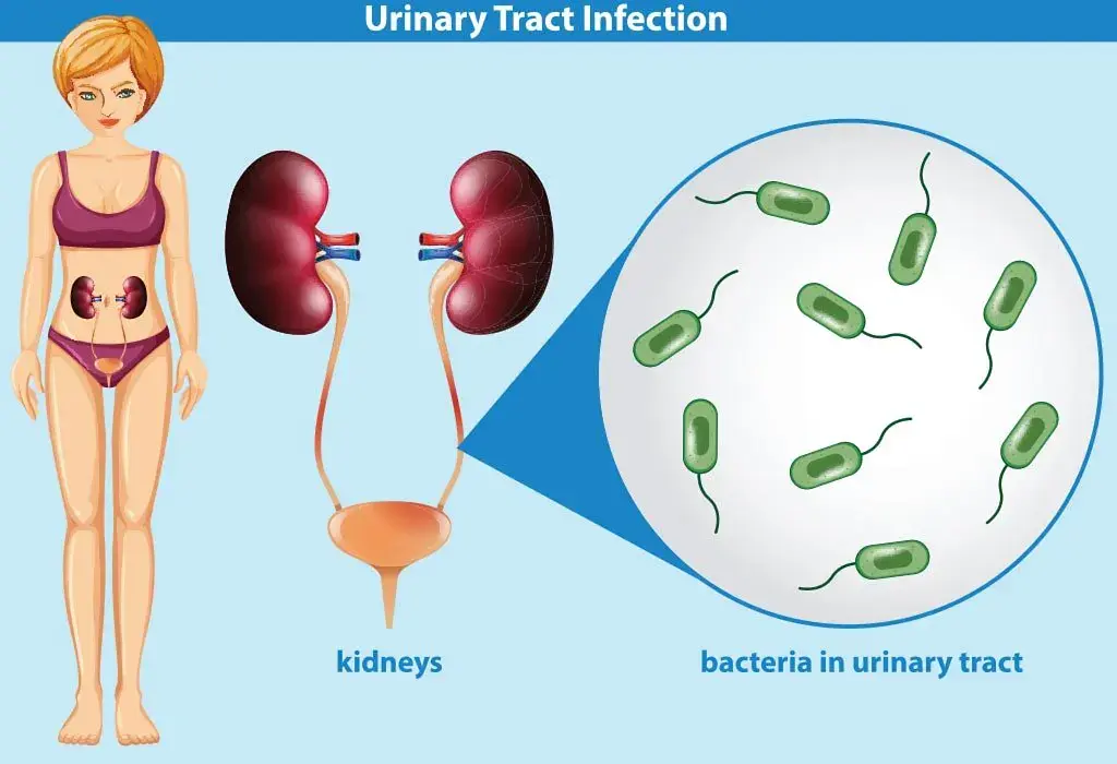 Increased leukocytes in urine during pregnancy, causes