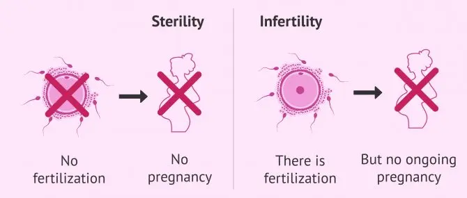 Infertility (sterility) &#8211; References