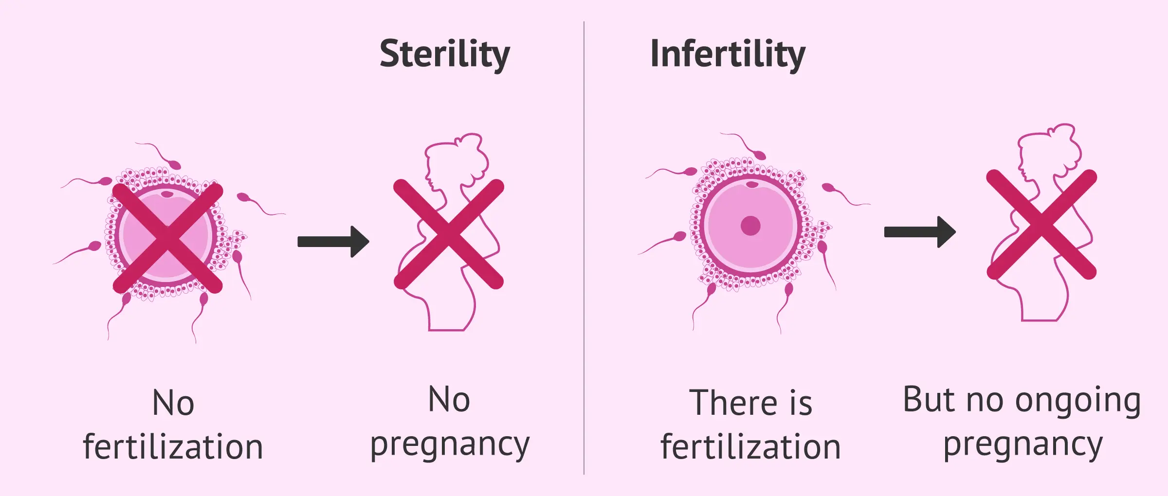 Infertility (sterility)