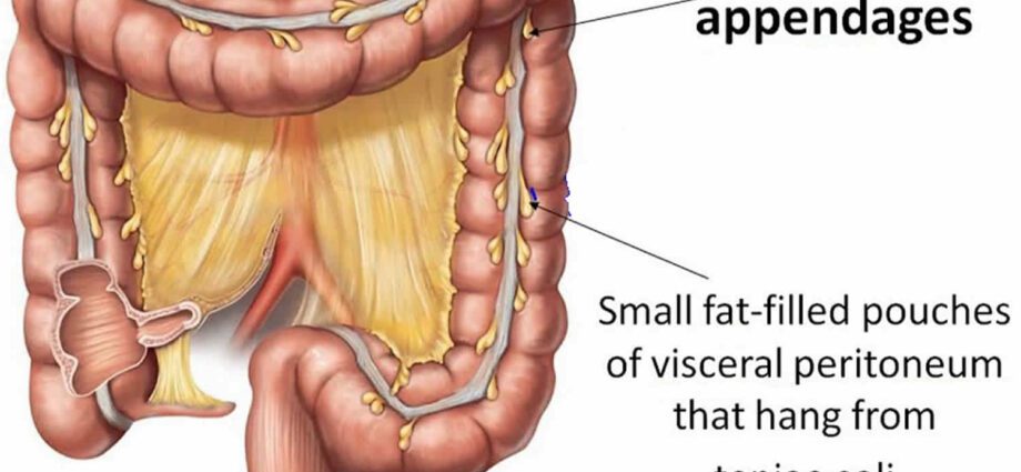 Inflammation of the appendages: treatment with one or more remedies. Video