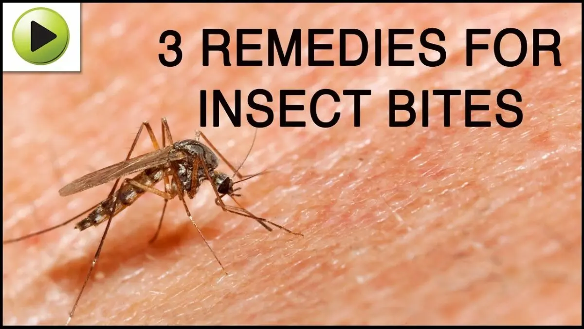 Insect bites: treatments and folk remedies. Video