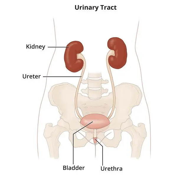 Interstitial cystitis (painful bladder syndrome)